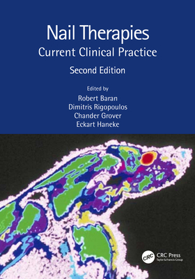 Nail Therapies: Current Clinical Practice - Baran, Robert (Editor), and Rigopoulos, Dimitris (Editor), and Grover, Chander (Editor)