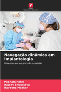 Navega??o din?mica em Implantologia