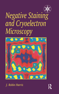 Negative Staining and Cryoelectron Microscopy: The Thin Film Techniques