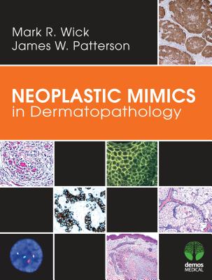 Neoplastic Mimics in Dermatopathology - Wick, Mark R, MD, and Patterson, James W, MD