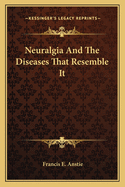 Neuralgia And The Diseases That Resemble It