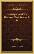 Neuralgia and the Diseases That Resemble It