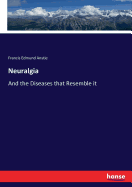 Neuralgia: And the Diseases that Resemble it