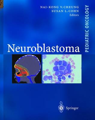 Neuroblastoma - Cheung, N -K V, and Cheung, NAI-Kong V (Editor), and Cohn, Susan L (Editor)