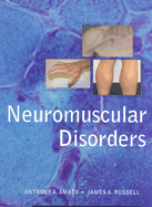 Neuromuscular Disorders