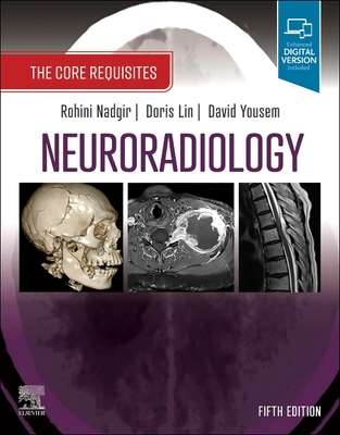 Neuroradiology: The Core Requisites - Nadgir, Rohini, MD (Editor), and Lin, Doris (Editor), and Yousem, David M., MD, MBA (Editor)
