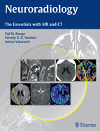 Neuroradiology: The Essentials with MR and CT