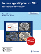 Neurosurgical Operative Atlas: Functional Neurosurgery