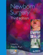 Newborn Surgery