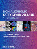 Non-Alcoholic Fatty Liver Disease: A Practical Guide