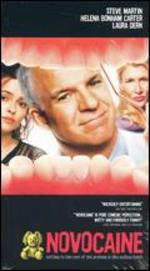 Novocaine
