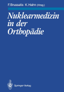 Nuklearmedizin in Der Orthop�die