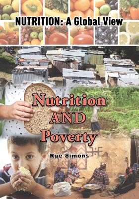Nutrition and Poverty - Simons, Rae