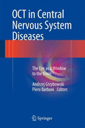 Oct in Central Nervous System Diseases: The Eye as a Window to the Brain