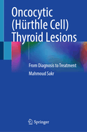 Oncocytic (H?rthle Cell) Thyroid Lesions: From Diagnosis to Treatment