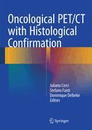 Oncological Pet/CT with Histological Confirmation