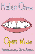 Open Wide: Set 4