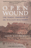 Open Wound: The Tragic Obsession of Dr. William Beaumont