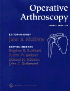 Operative Arthroscopy