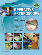 Operative Arthroscopy