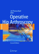 Operative Hip Arthroscopy