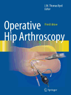 Operative Hip Arthroscopy
