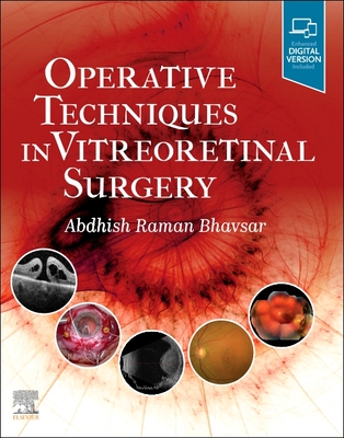 Operative Techniques in Vitreoretinal Surgery - Bhavsar, Abdhish R, MD (Editor)