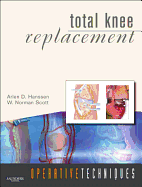 Operative Techniques: Total Knee Replacement: Book, Website and DVD
