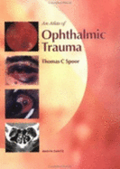 Ophthalmic Trauma Atlas - Spoor