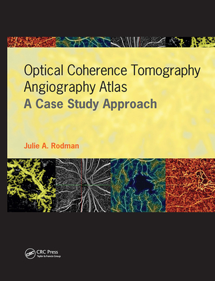 Optical Coherence Tomography Angiography Atlas: A Case Study Approach - Rodman, Julie, and Esmaili, Dan