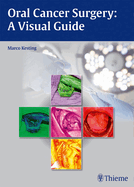 Oral Cancer Surgery: A Visual Guide
