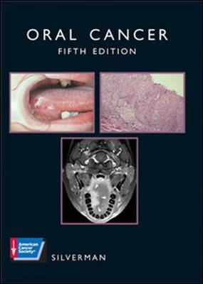Oral Cancer - Silverman, Sol (Editor)