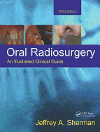 Oral Radiosurgery: An Illustrated Clinical Guide