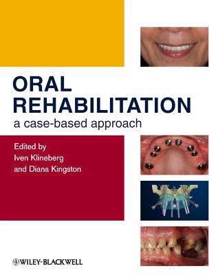 Oral Rehabilitation: A Case-Based Approach - Klineberg, Iven (Editor), and Kingston, Diana (Editor)
