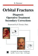Orbital Fractures: Diagnosis, Operative Treatment, Secondary Corrections