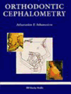 Orthodontic Cephalometry