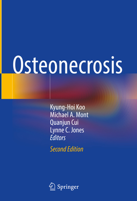 Osteonecrosis - Koo, Kyung-Hoi (Editor), and Mont, Michael A (Editor), and Cui, Quanjun (Editor)