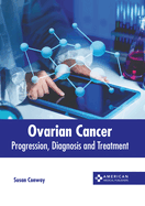 Ovarian Cancer: Progression, Diagnosis and Treatment
