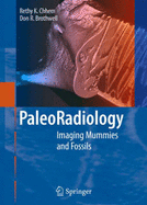 Paleoradiology: Imaging Mummies and Fossils - Chhem, R K, and Brothwell, D R