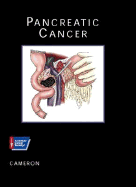 Pancreatic Cancer
