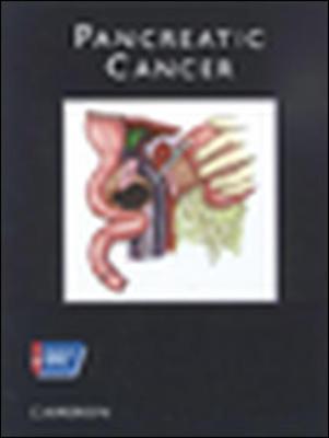 PANCREATIC CANCER - CAMERON