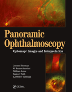 Panoramic Ophthalmoscopy: Optomap Images and Interpretation