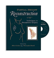 Partial Breast Reconstruction: Techniques in Oncoplastic Surgery