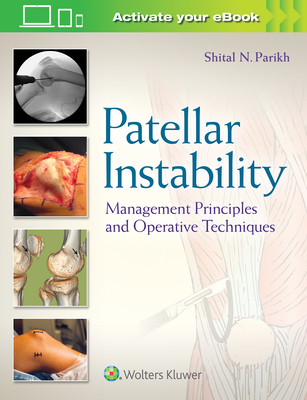 Patellar Instability: Management Principles and Operative Techniques - Parikh, Shital N, Dr., MD (Editor)