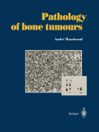 Pathology of Bone Tumours: Personal Experience