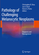 Pathology of Challenging Melanocytic Neoplasms: Diagnosis and Management