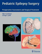 Pediatric Epilepsy Surgery: Preoperative Assessment and Surgical Treatment
