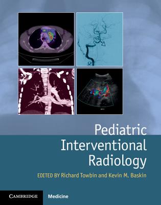 Pediatric Interventional Radiology - Towbin, Richard (Editor), and Baskin, Kevin (Editor)