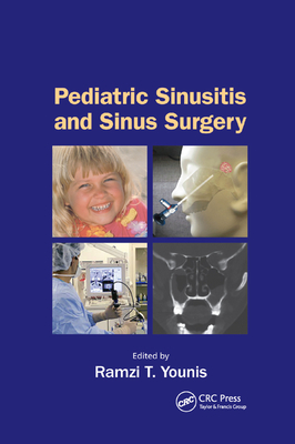 Pediatric Sinusitis and Sinus Surgery - Younis, Ramzi T. (Editor)