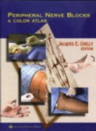 Peripheral Nerve Blocks: A Color Atlas